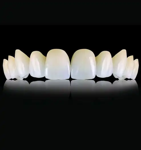 Monolitik zirkonyum CAD/CAM restorasyon &ndash; Esnan Digital Lab